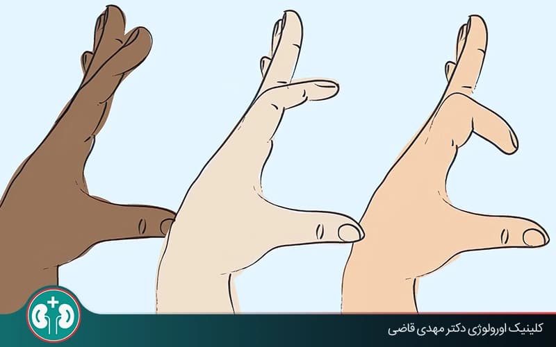 اندازه استاندارد آلت تناسلی چقدر است؟ + روش دقیق اندازه‌گیری