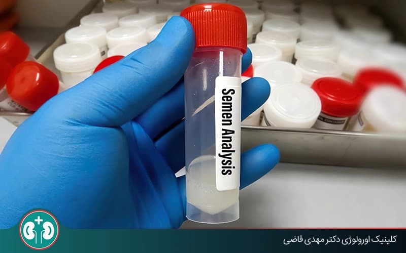 Semen Analysis After Vasectomy: Timing, Method, and Results