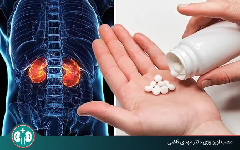 9 Kidney Pain Medicines: Strong Pain Relief for Kidney Stones and Side Effects | Dr. Mahdi Ghazi