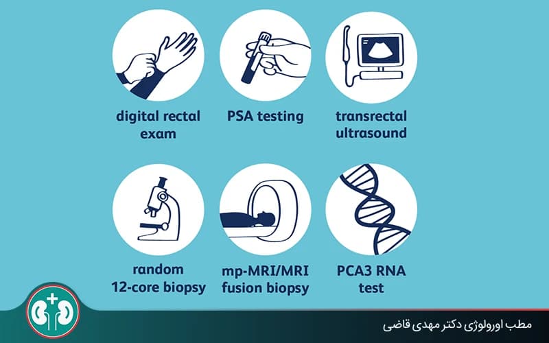 Prostate Cancer Diagnosis: From PSA Blood Test to Biopsy