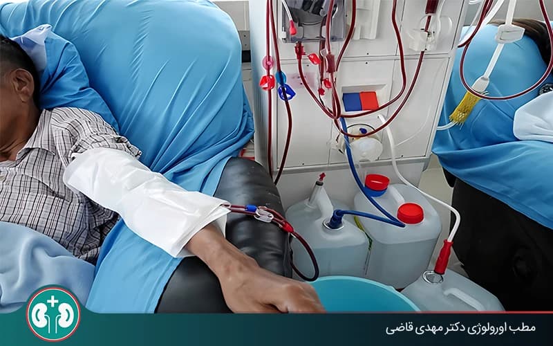دیالیز چیست و چگونه انجام می‌شود؟