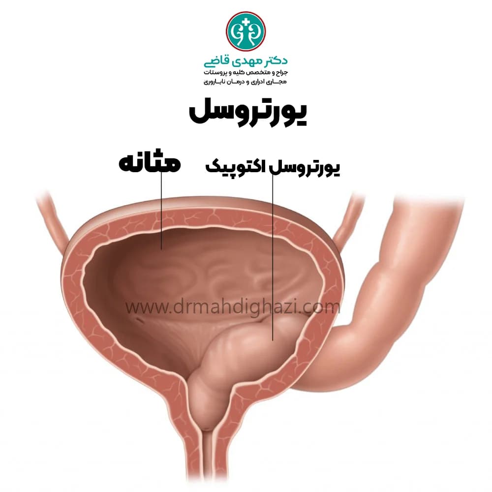 الدكتور مهدي قاضي-یورتروسل