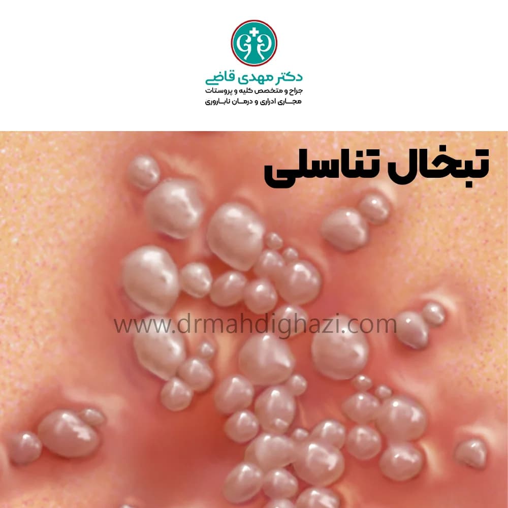 دکتر قاضی- تبخال تناسلی