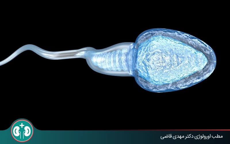 What Happens to Sperm After Vasectomy?