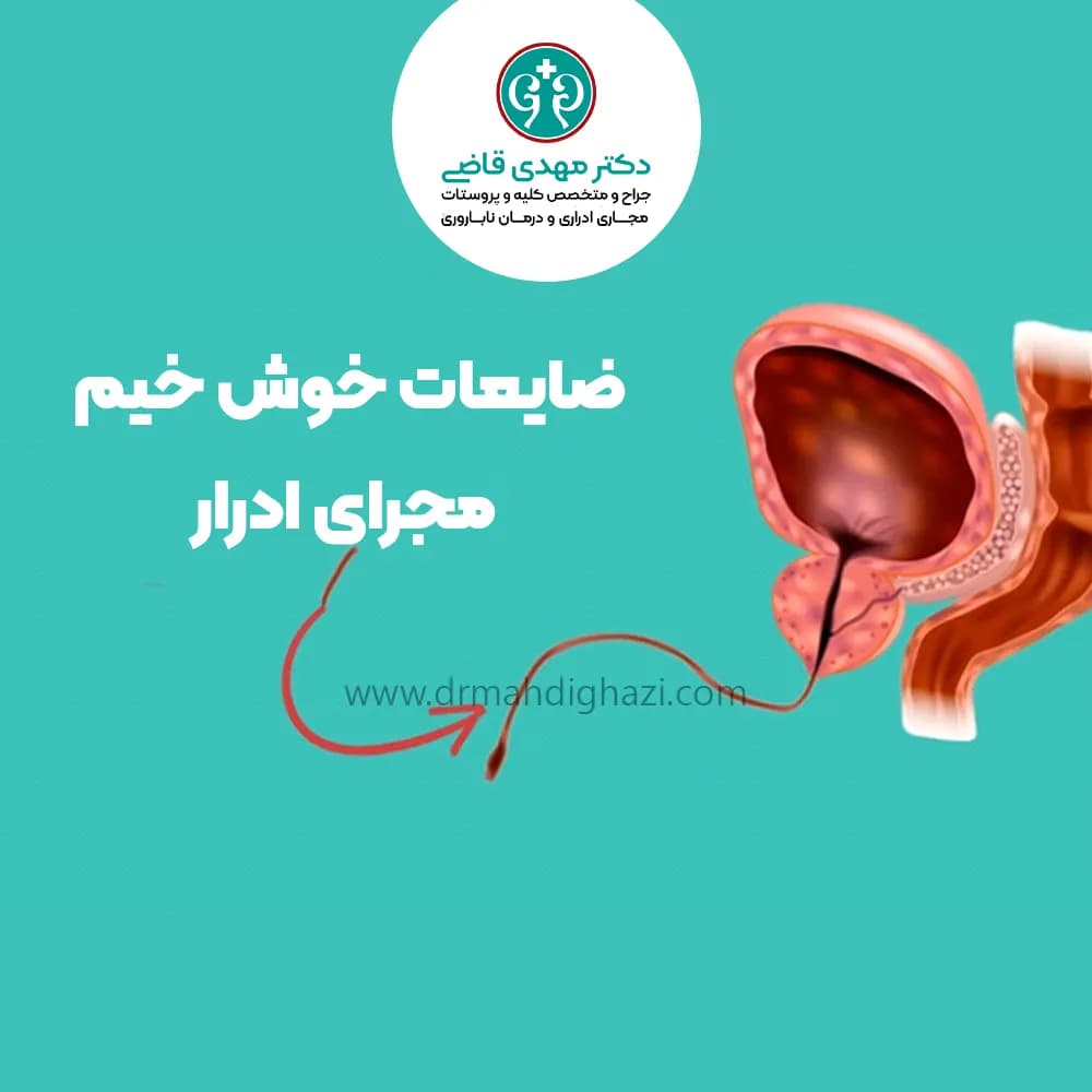 Benign Urethral Lesions in Adults