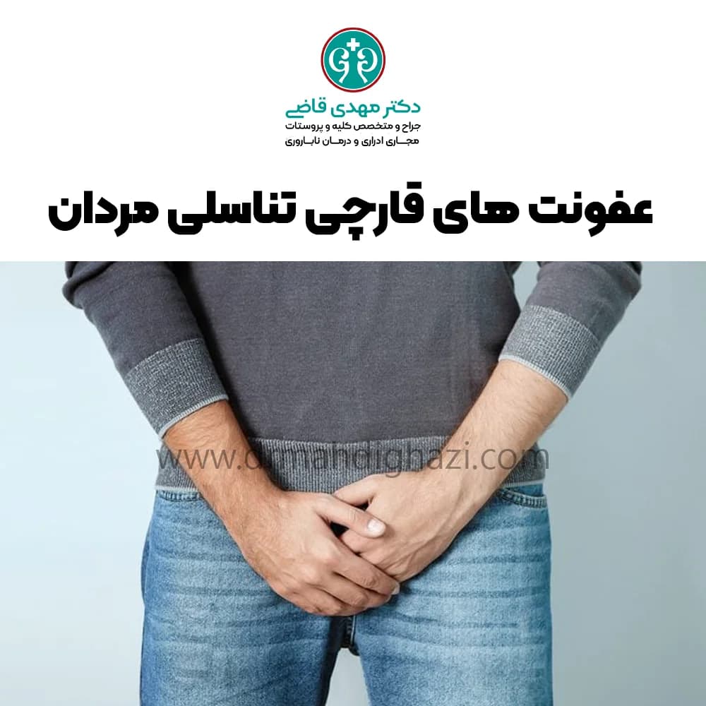 عفونت های قارچی تناسلی مردان -دکتر قاضی