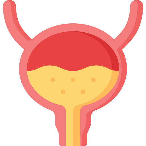Bladder disease specialist