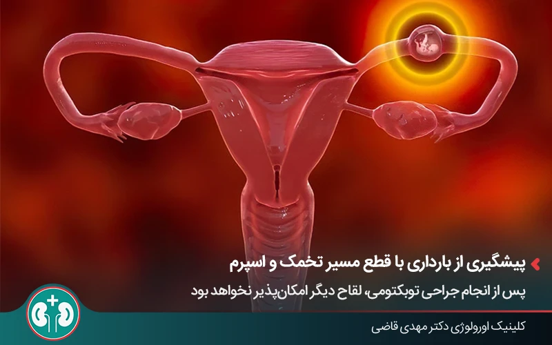 نحوه عملکرد لوله‌های فالوپ در انتقال تخمک و تأثیر توبکتومی بر ناباروری