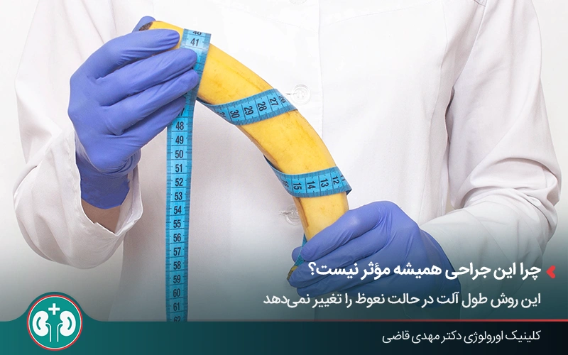 اندازهگیری طول آلت قبل از جراحی افزایش طول آلت تناسلی