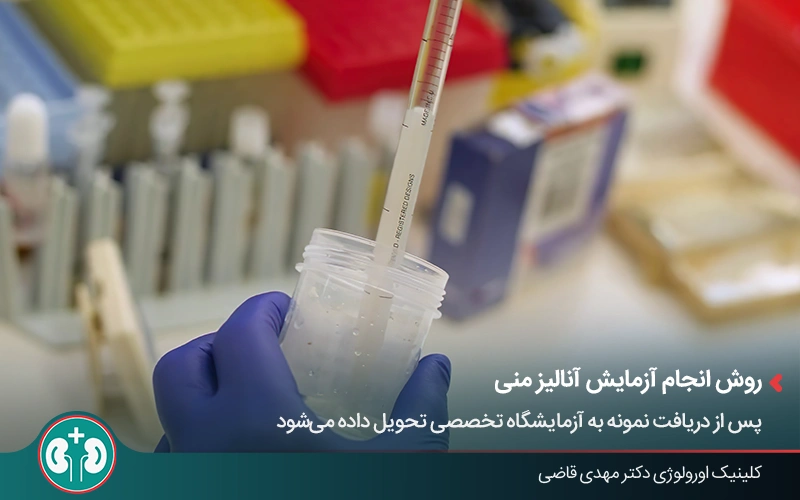 بررسی موفقیت وازکتومی با تست اسپرم و آنالیز نمونه در آزمایشگاه