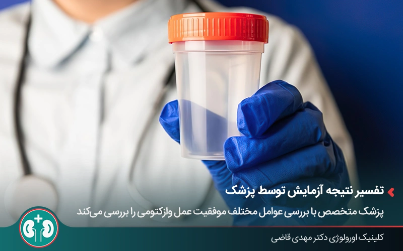 Sperm test after vasectomy for result interpretation and fertility assessment