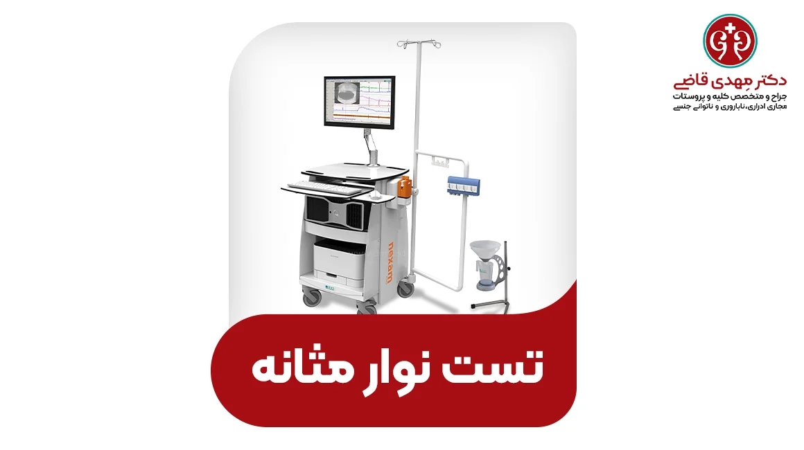 تست نوار مثانه