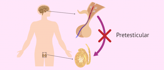 آزواسپرمی پیش بیضه