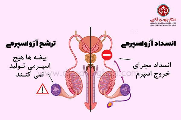 azoospermia