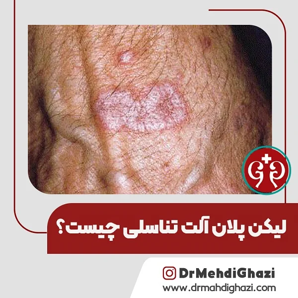 لیکن پلان چیست
