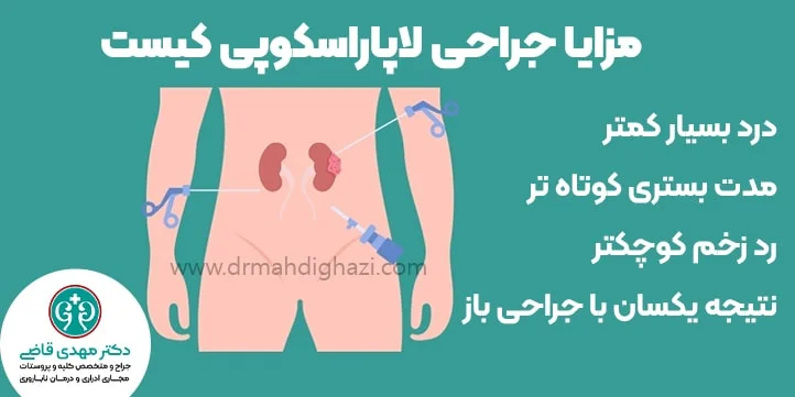 مزایای جراحی لاپاراسکوپی کیست دکتر قاضی