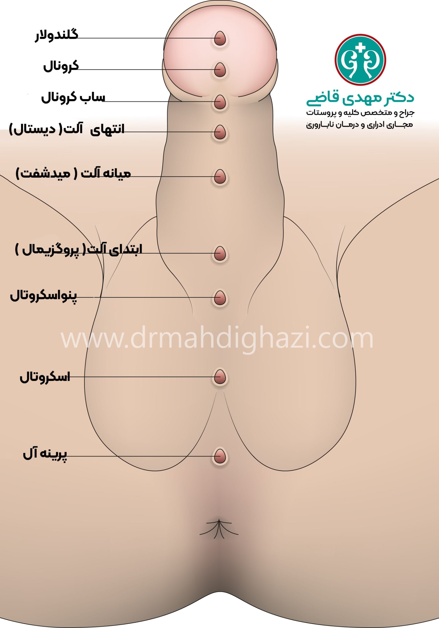 دکتر قاضی -انواع هیپوسپادیاس