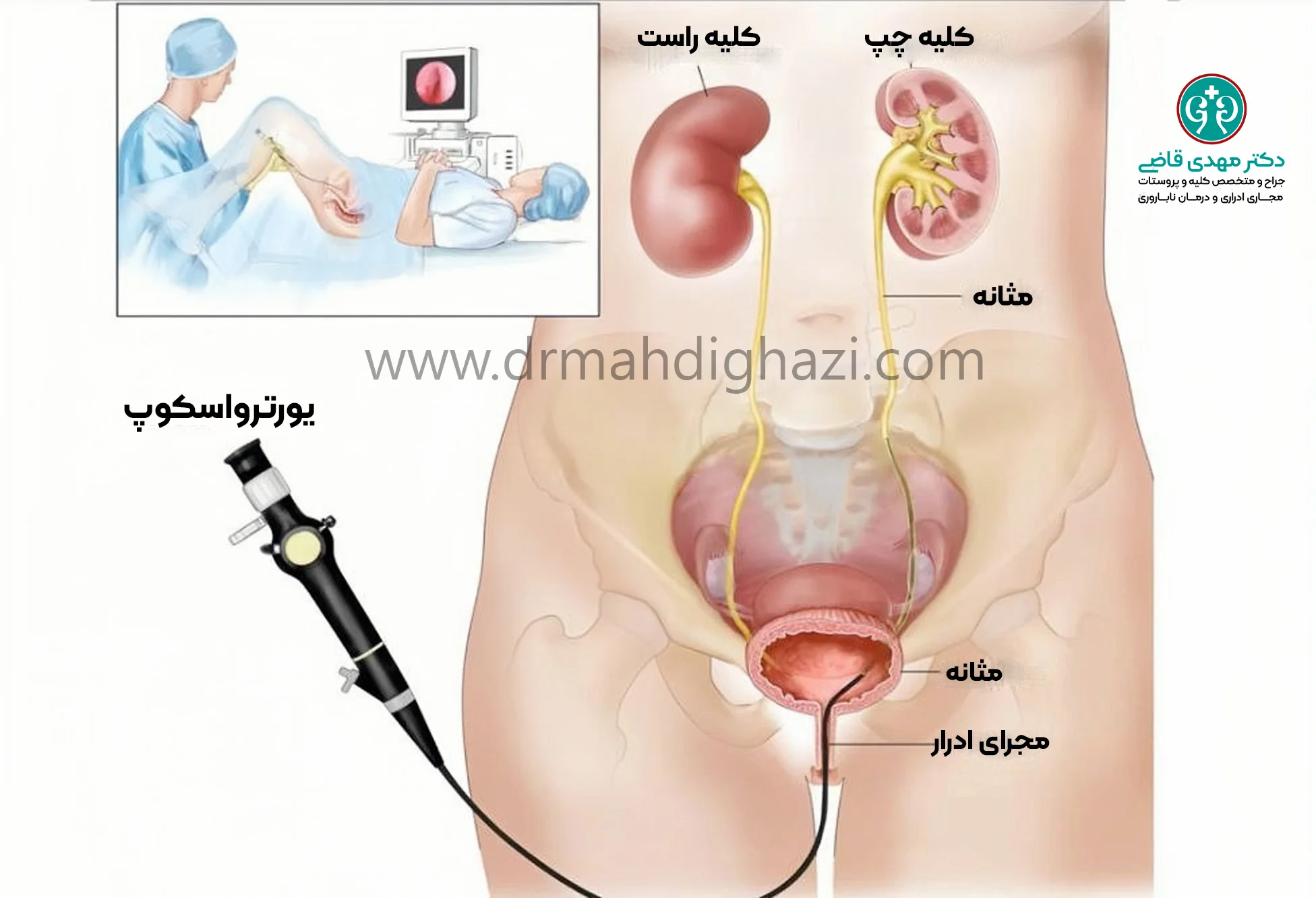 دکتر قاضی روشهای تشخیص سرطان کلیه و حالب