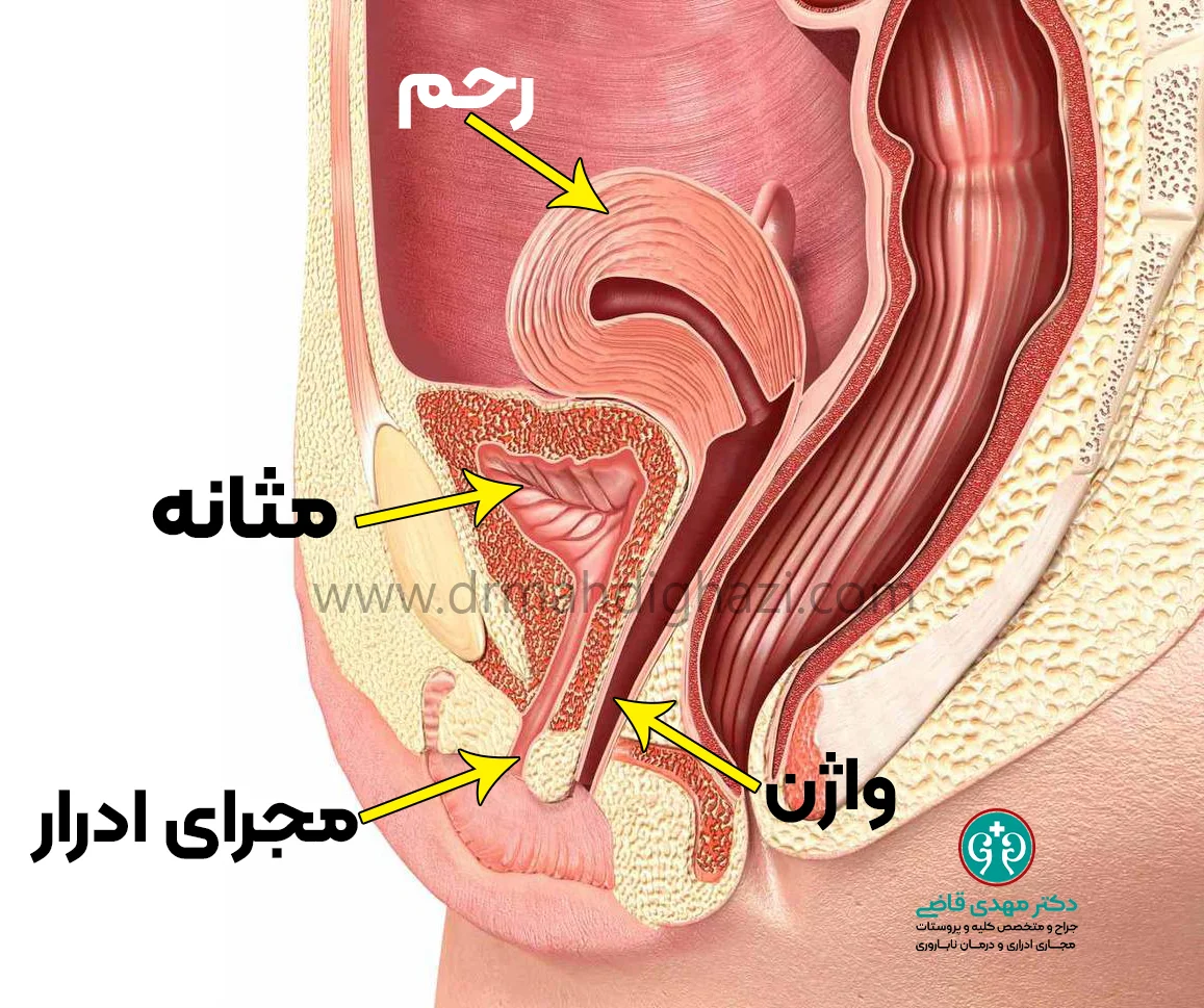 دکتر قاضی-• کارونکل مجرای ادرار-• علائم تودههای خوش خیم مجرای ادرار در دختران