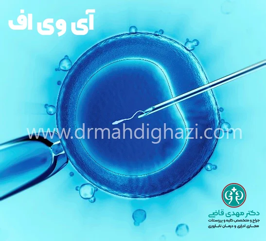 دکتر قاضی- آی وی اف بهترین روشهای درمان ناباروری