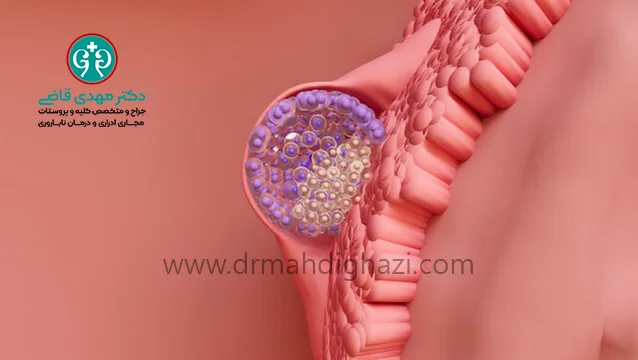 دکتر قاضی-• IVF • لقاح مصنوعی