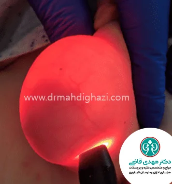 دکتر قاضی-هیدروسل چیست