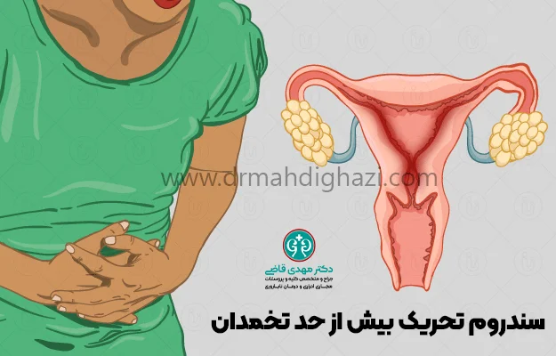 دکتر قاضی- بهترین روش‌های درمان ناباروری