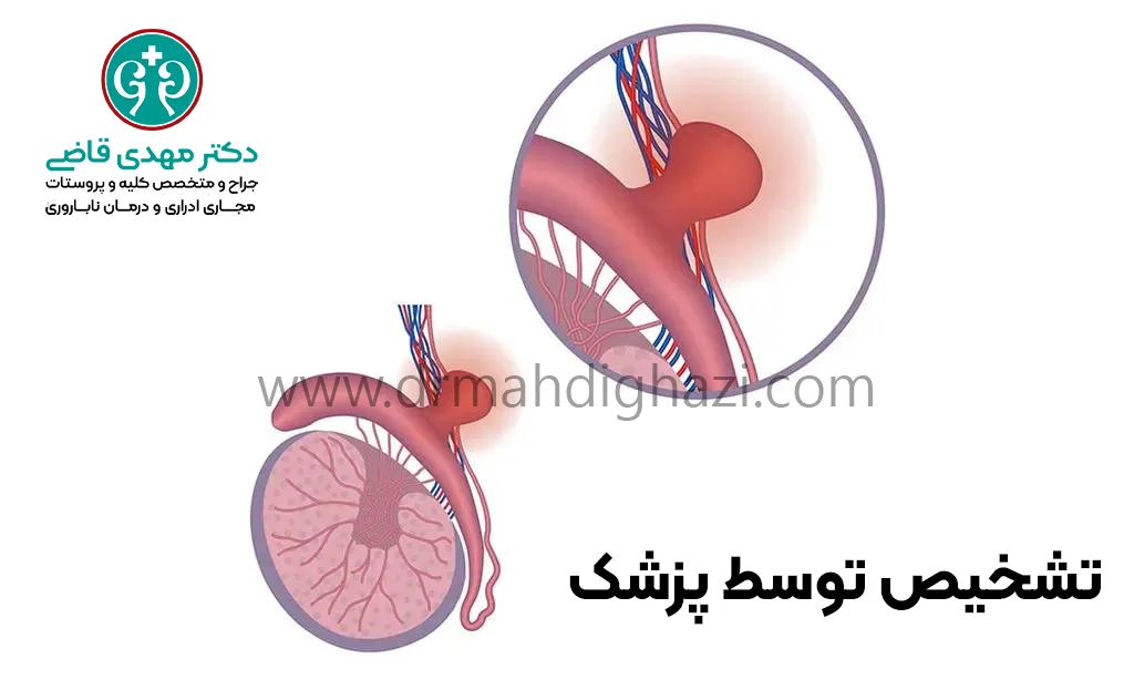 دکتر قاضی- تشخیص کیست اپیدیدیم
