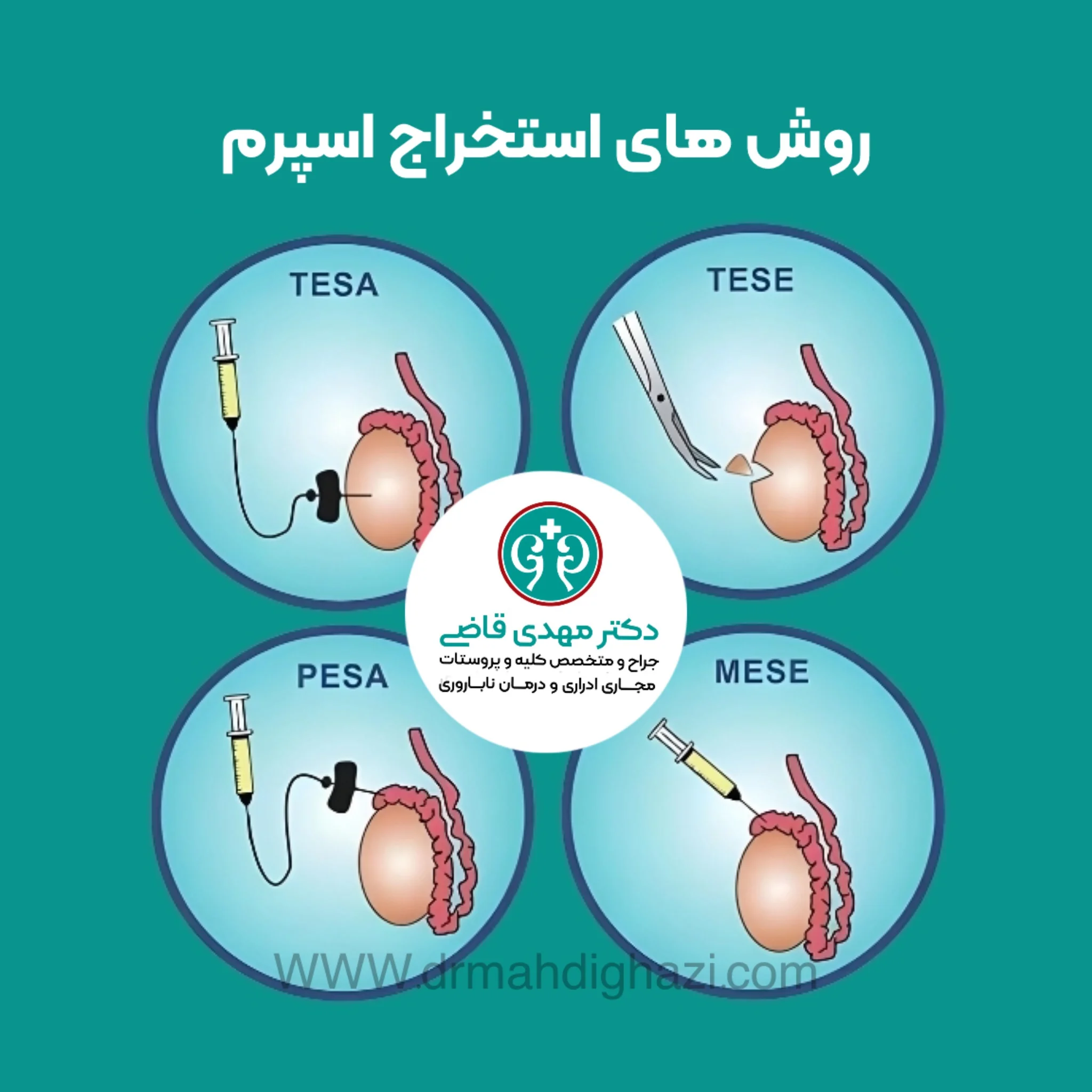 دکتر قاضی-ناباروری مردان