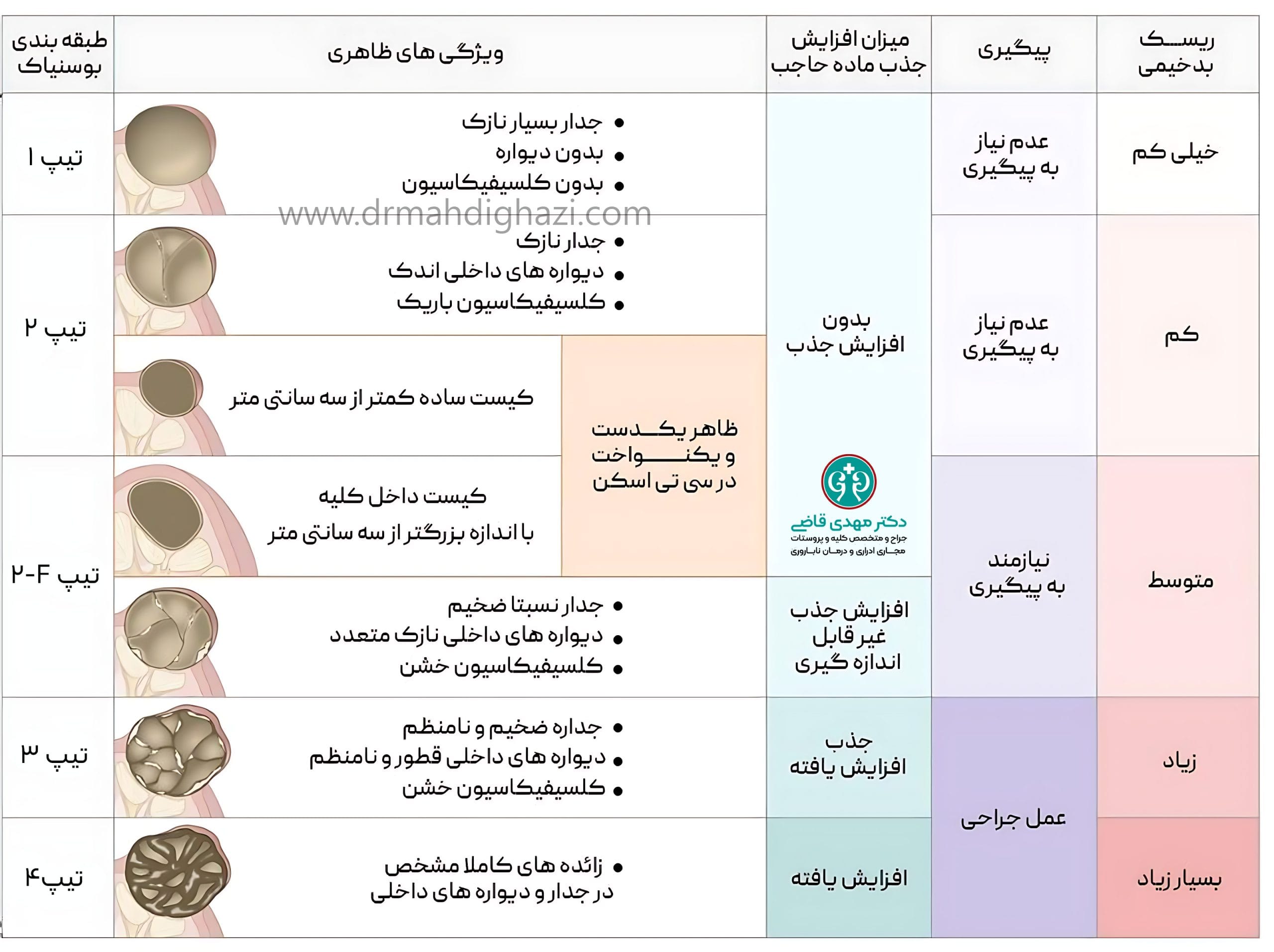 دکتر قاضی- علائم کیست کلیه