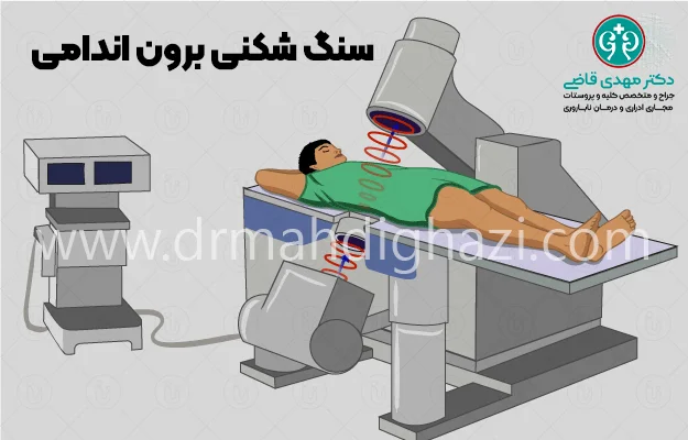 دکتر قاضی- کیست کلیه: علل، علائم، تشخیص و روشهای درمان