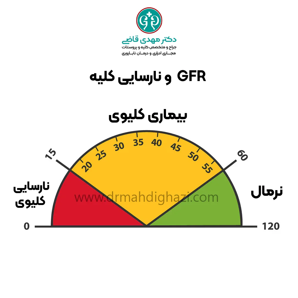 دکتر قاضی-نارسایی کلیه: راهنمای کامل تشخیص ,درمان و پیشگیری