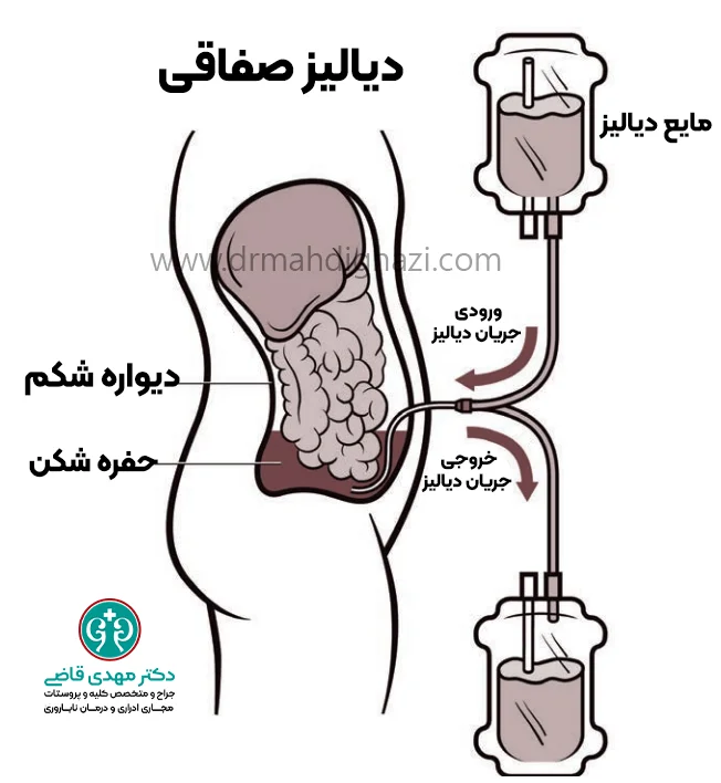 دکتر قاضی-ننارسایی کلیه: راهنمای کامل تشخیص ,درمان و پیشگیری