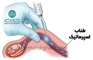 دکتر قاضی- درد بیضه