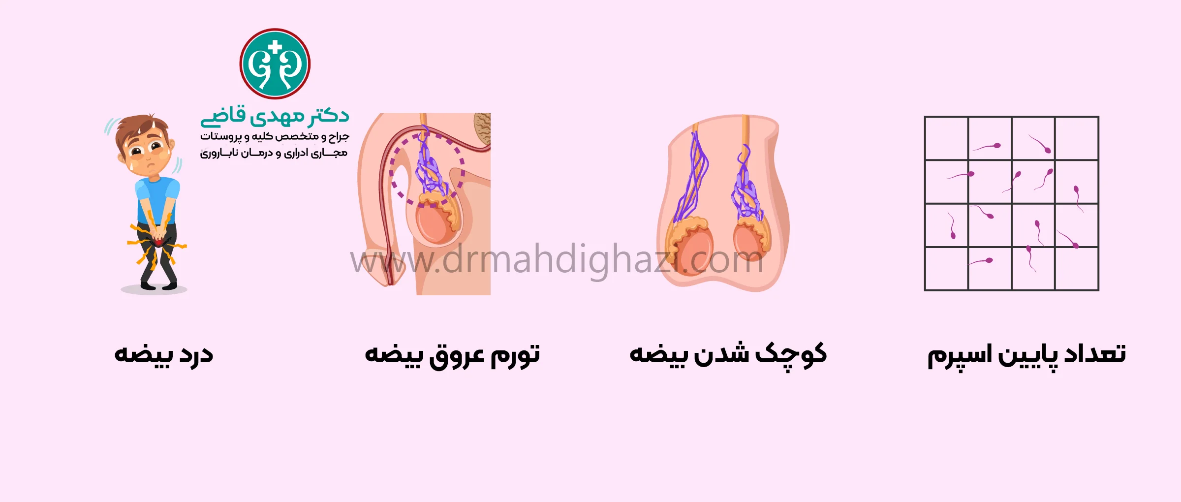 دکتر قاضی- مراحل واریکوسل