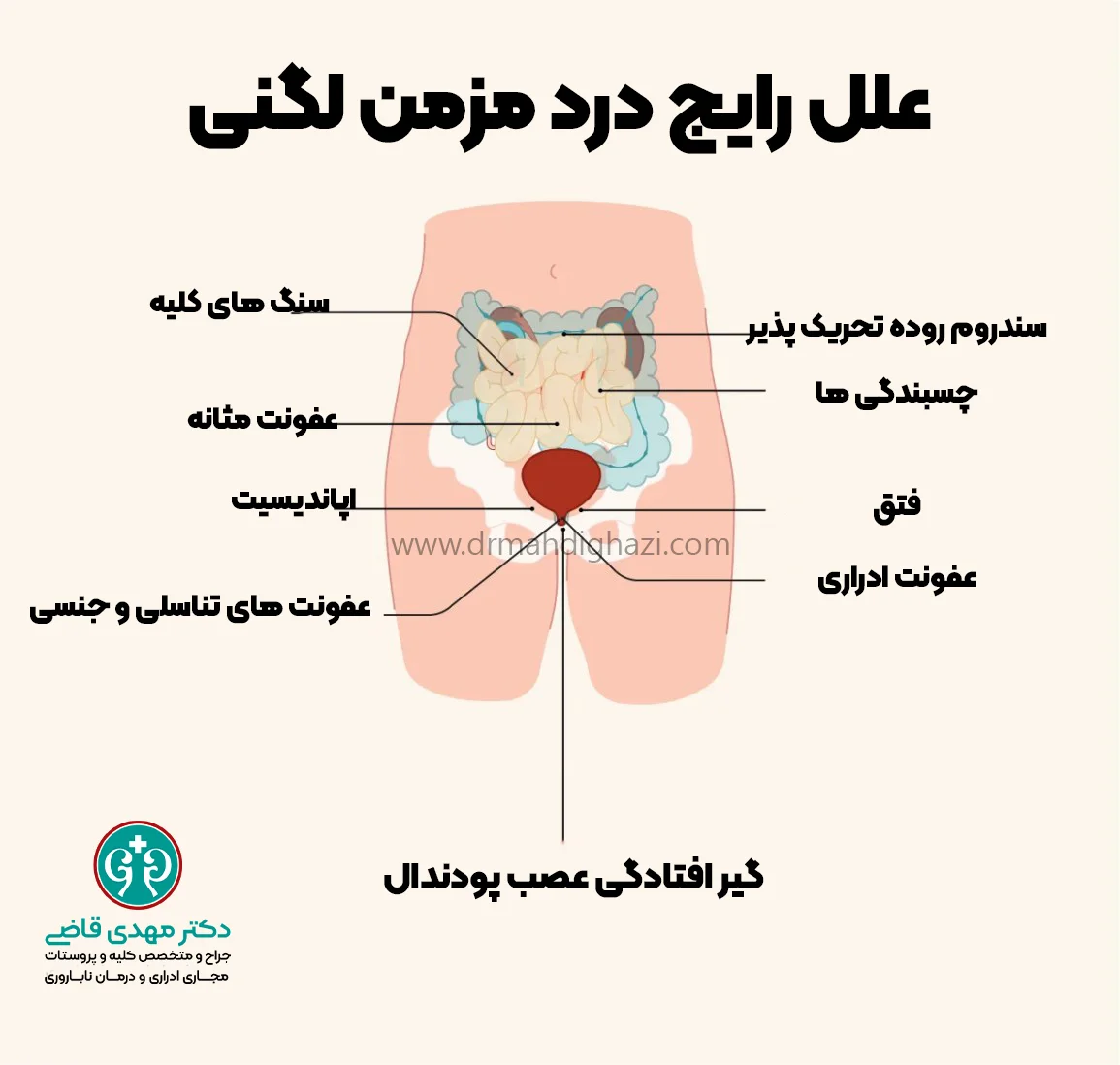 دکتر قاضی- علل درد مزمن لگنی