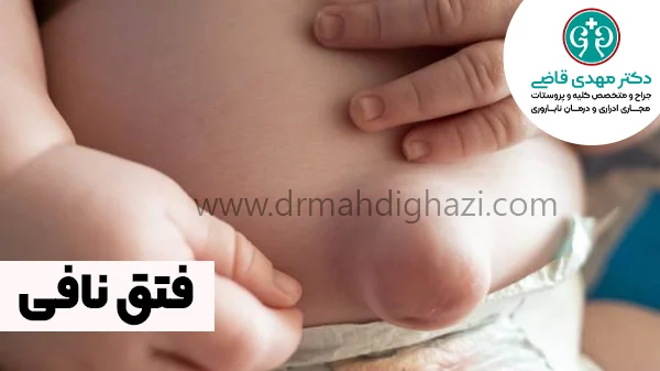 دکتر قاضی- فتق نافی