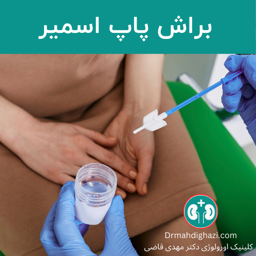 براش (برس) جهت نمونه برداری برای بررسی تغییرات سلولی بافت در تست پاپ اسمیر