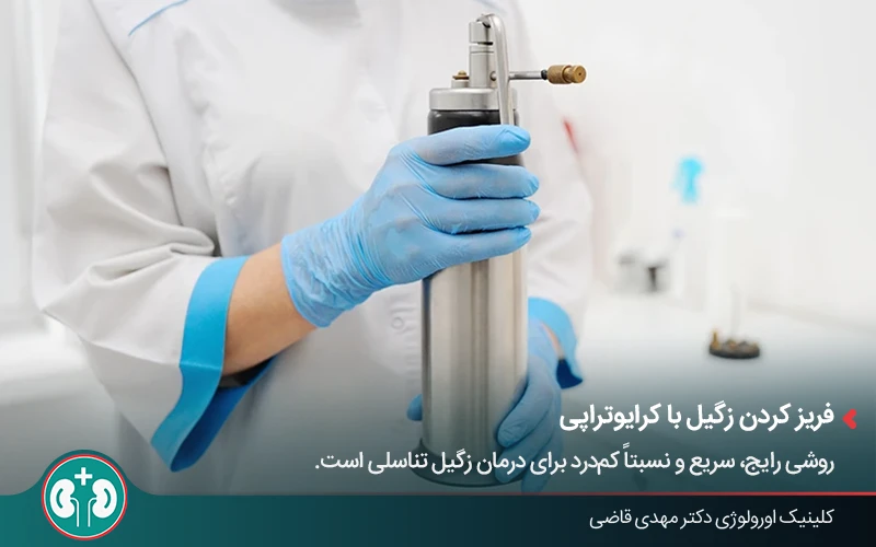کرایوتراپی؛ یکی از روشهای درمان زگیل تناسلی